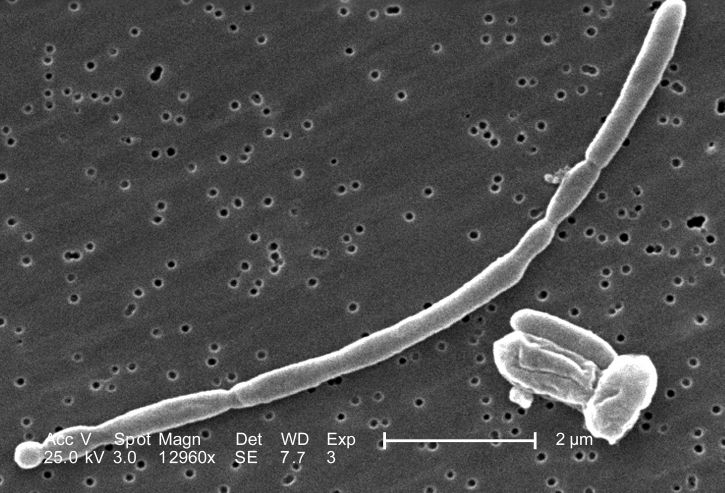 morfologické detaily, připojil na gram, negativní, escherichia coli, bakterie, bakterie