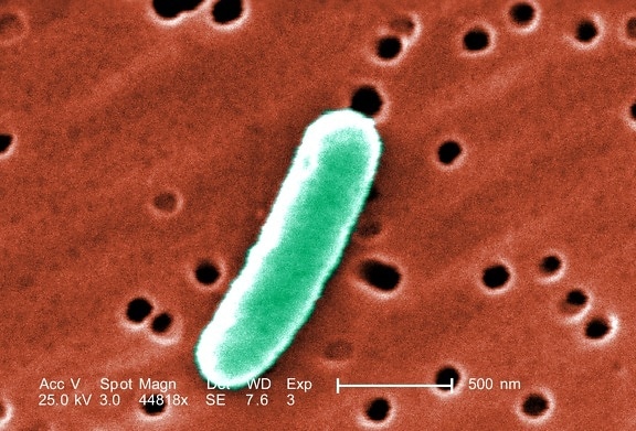 detalles morfológicos, sola, gramo, negativo, Escherichia coli, una bacteria
