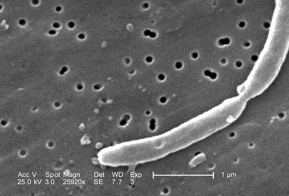 détails morphologiques, deux, rejoints, gram, négatif, escherichia coli, des bactéries