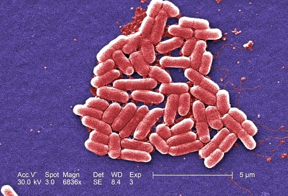 gram, negativ, Escherichia Coli, bakterier