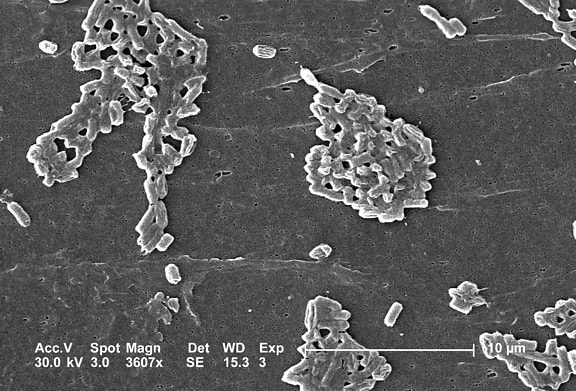 escherichia coli, des bactéries, formées, coloniales, des groupements