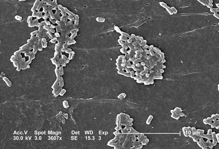 Escherichia coli, bakterie, formátované, koloniální, seskupení