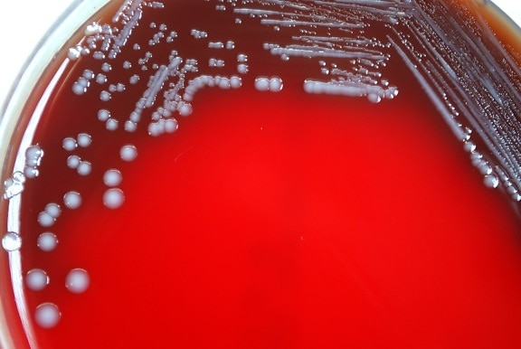 ภาพถ่าย อาณานิคม สัณฐานวิทยา กรัม ลบ yersinia pestis แบคทีเรีย