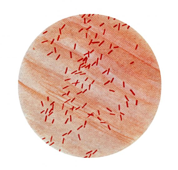 Mikrophotographie, Escherichia coli, Bacillus, coli, Bakterien, Gramm, Fleck, Technik