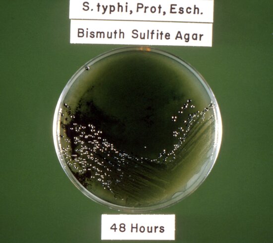 Imagem gratuita: Escherichia coli, medula espinal, mancha, coloridas ...