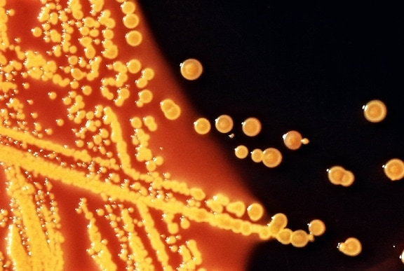 colonies, escherichia coli, bactéries, cultivées, Hektoen, entérique, agar, plaque, moyen