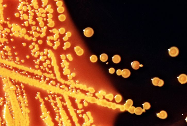 kolonier, escherichia coli bakterier, vokst, hektoen, enteric, agar, plate, medium
