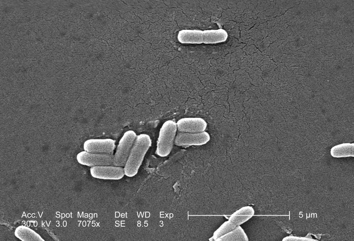 balayage, micrographie électronique, gramme, négatif, escherichia coli, bactéries