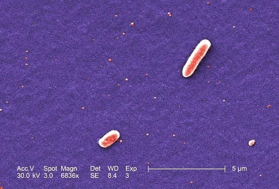 deux, gram, négatif, Escherichia, coli, bactéries, souche, O157, coli