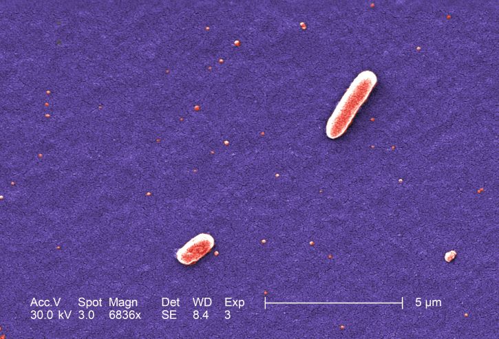dva, grama, negativan, Escherichia coli, bakterije, soj O157, coli