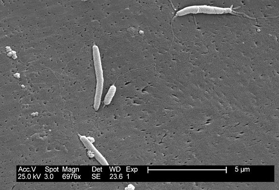 flexispira rappini, bacteriën, uitvergroot, 6976 x