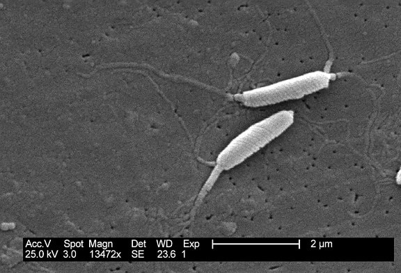flexispira rappini, бактерии, отблизо, свързани, helicobacter