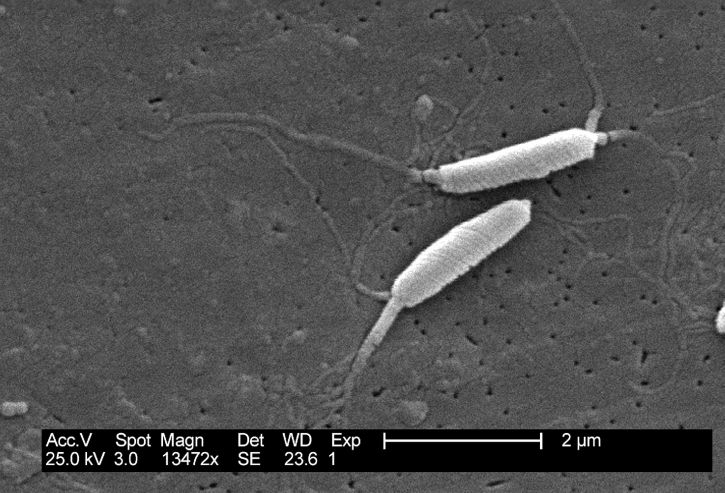 flexispira rappini, vi khuẩn, liên quan chặt chẽ, helicobacter