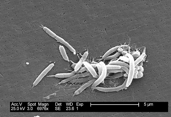 flexispira rappini, bacteriën, vervolgens bepaald, nauw, gerelateerde, helicobacter