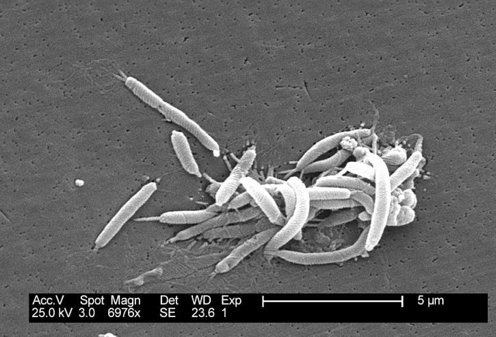 flexispira rappini, пов'язані з бактерій, згодом, визначена, тісно, helicobacter