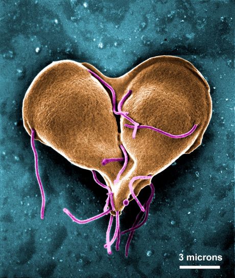 Giardia lamblia, protozoan, twee