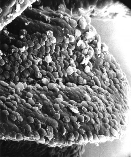 Giardia, trophozoiták kimutatása, teljesen borított villus