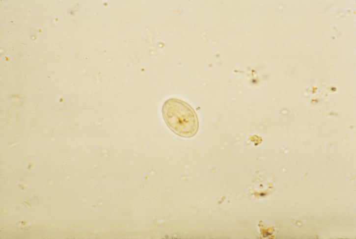 Ingyenes kép: Giardia lamblia parazita, jód, festés