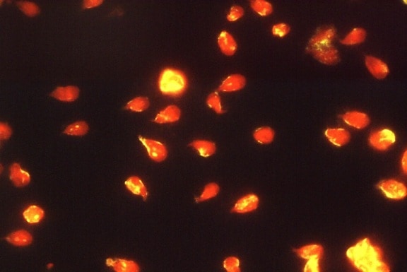 Giardia lamblia paraziták, immunfluoreszcens, teszt