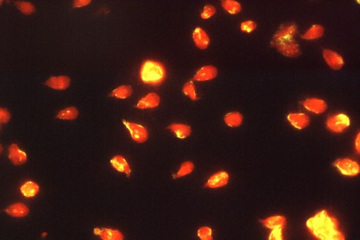 Giardia lamblia parasiter, immunofluorescens, test