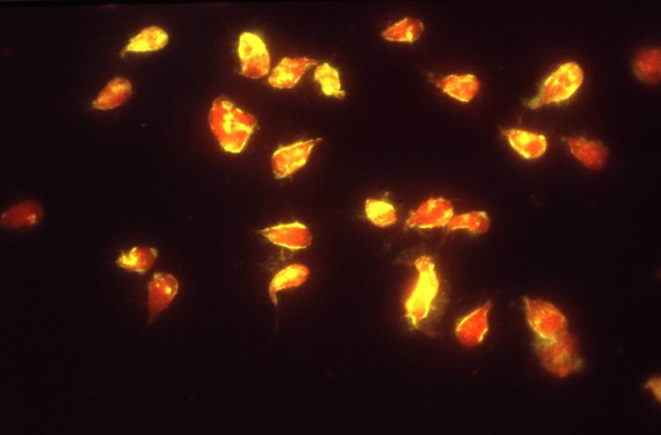 Giardia lamblia, paraziti, imunofluorescencija, test, giardiasisom, stanice