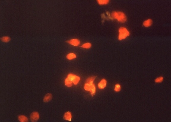 Giardia lamblia, paraziti, imunofluorescencija, test, giardiasisom