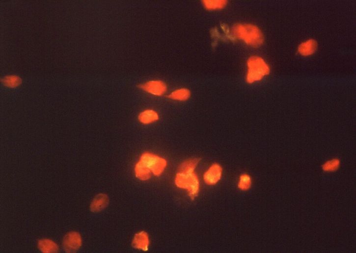 giardia lamblia, parásitos, inmunofluorescencia, ensayo, giardiasis