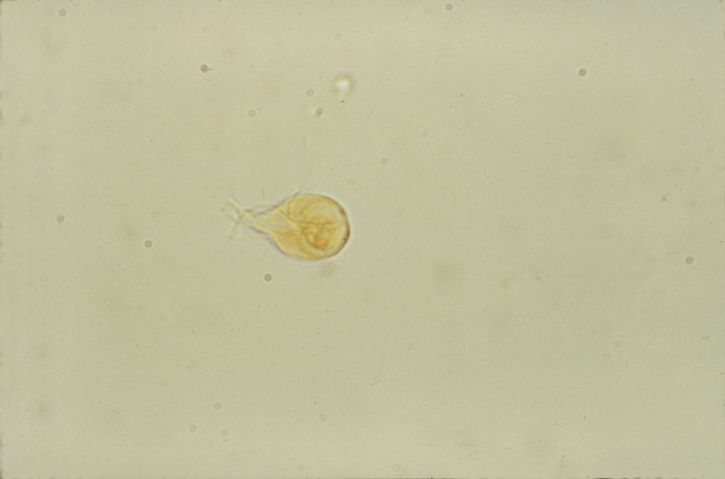 Giardia lamblia, trofozoítos, pequeno, intestino, aparecem, pera, moldada, organismos