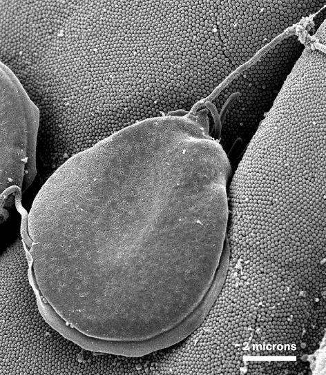 ไกรด์เดีย muris, protozoan ชำระ ลำไส้ เยื่อบุ ผิว ขน ยึดมั่น microvillous เส้นขอบ ลำไส้ เยื่อบุ ผิว เซลล์