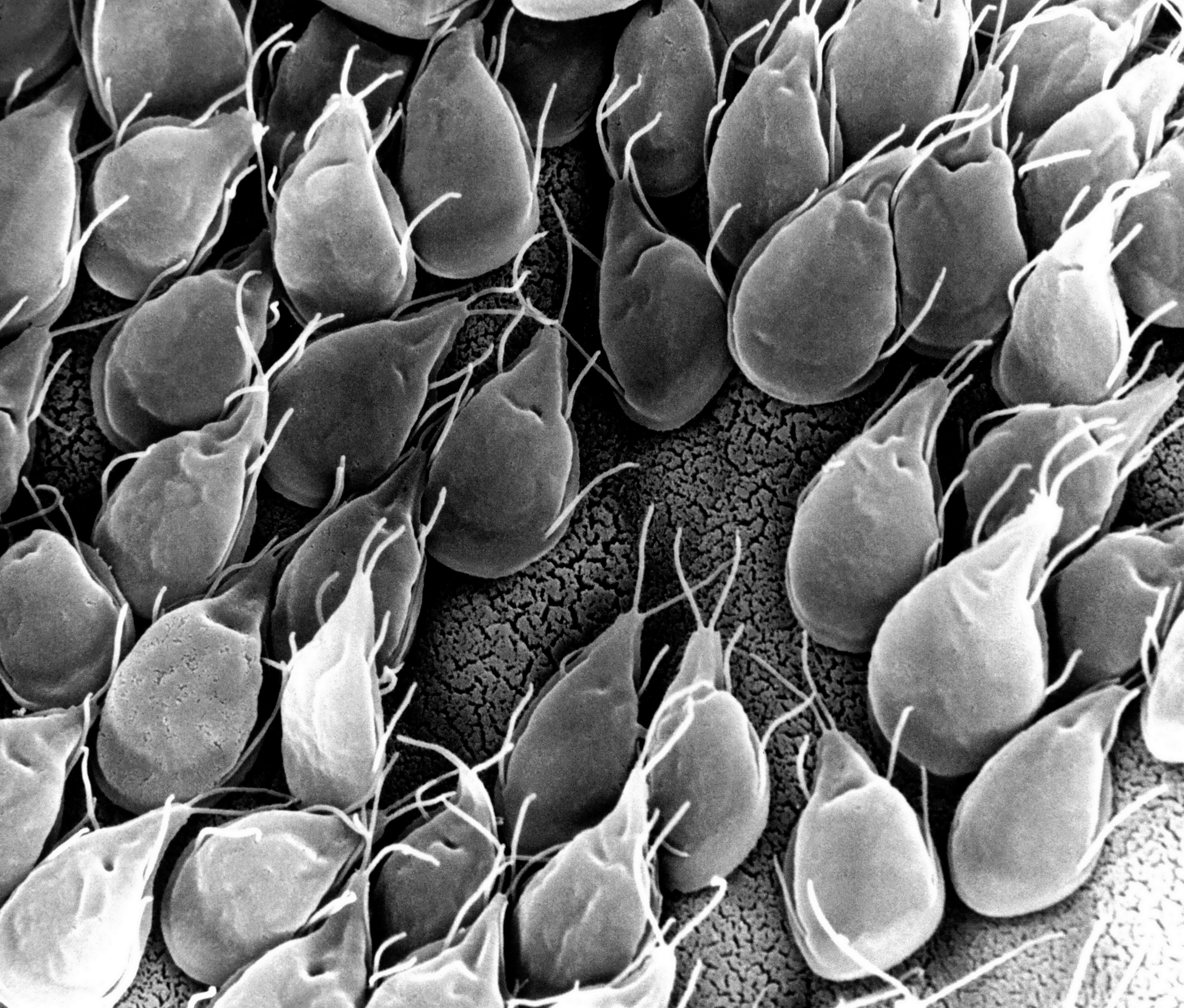 Imagini de protozoare de giardia Infectii Intestinale cu Protozoare si Tricomonaza