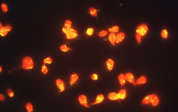 photomicrograph, giardia lamblia, protozoan, organism