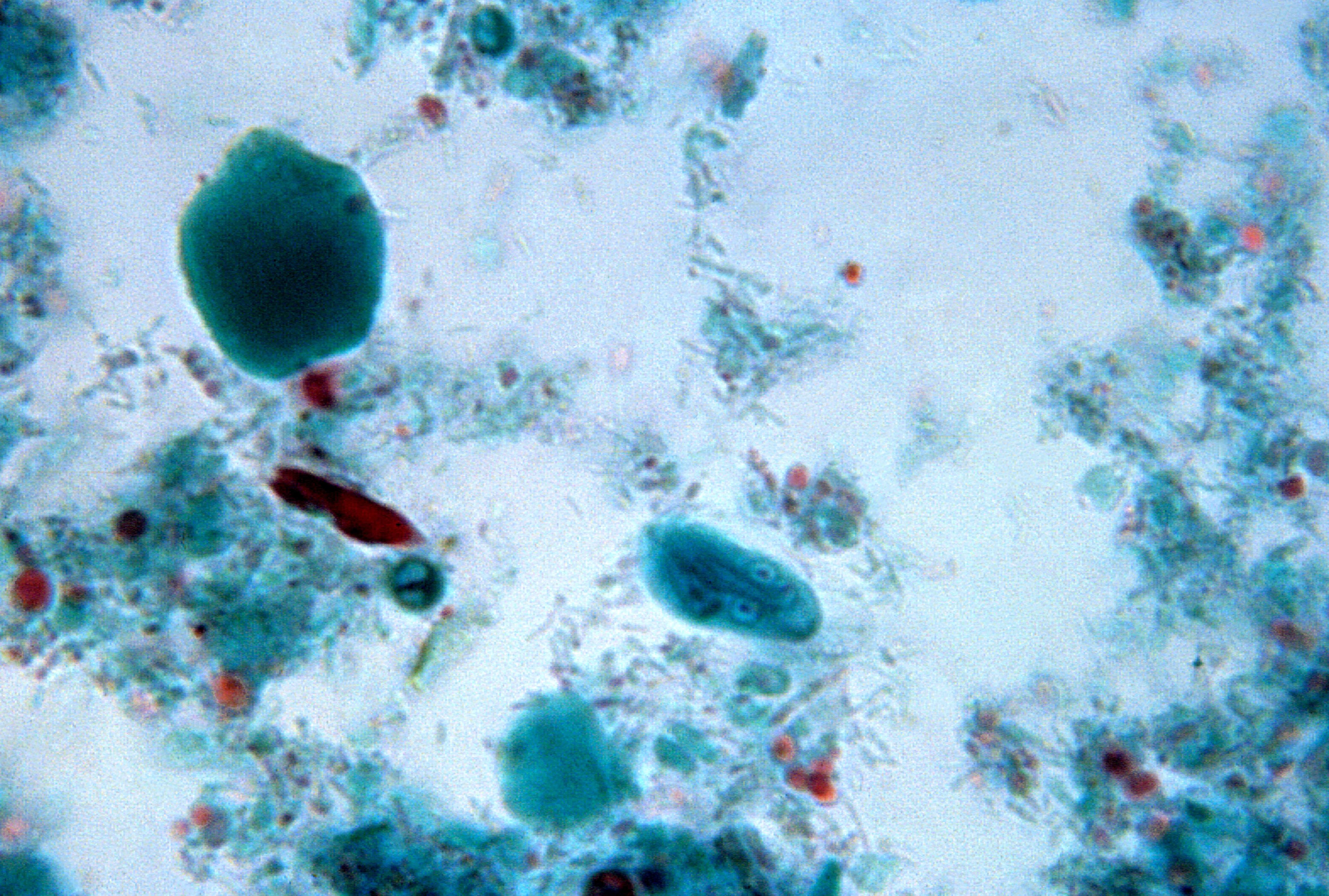 imagini de protozoare de giardia