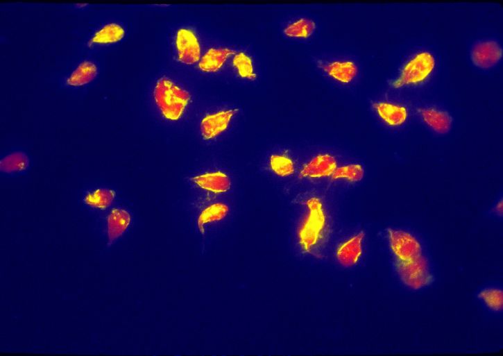 photomicrograph บวก immunofluorescence ทดสอบ ตรวจสอบ แสดงตน ไกรด์เดีย lamblia