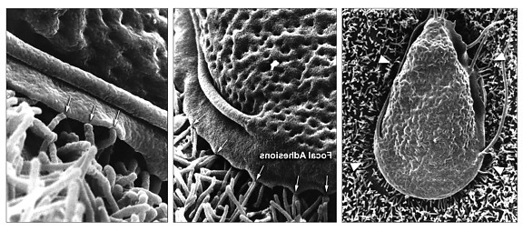 three, scanning, electron micrographs, successively, greater, magnifications