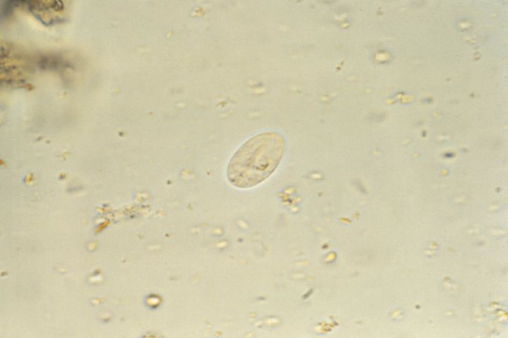microphotographie, Giardia, lamblia, parasite, iode, tache