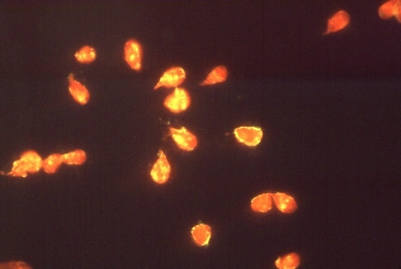 Fotomicrografia giardia lamblia, parasitas, imunofluorescência, teste, giardíase