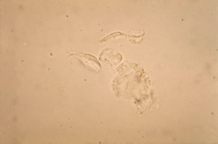 microphotographie, Giardia, lamblia, trophozoites, petit, intestin, infection, hôte