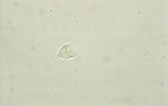 unphotomicrograph, giardia lamblia, trophozoite, sucking, disk, visible