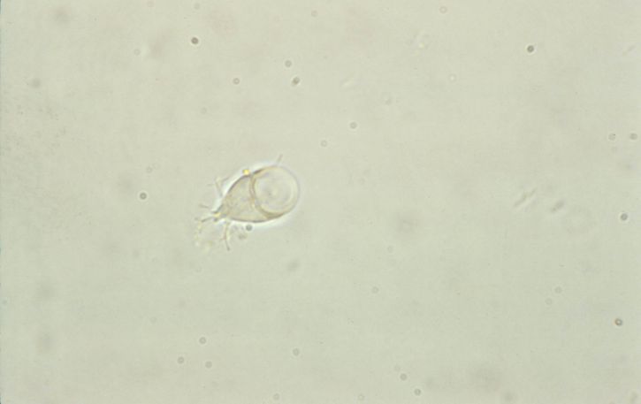 unphotomicrograph, giardia lamblia, trophozoite, sucking, disk, visible