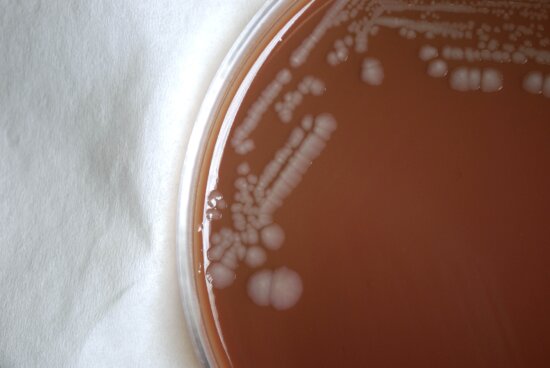 mallei, bacteria, infectious disease, glanders