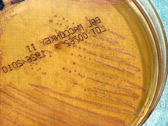 Free Picture: Gram, Negative, Burkholderia Pseudomallei, Bacteria ...