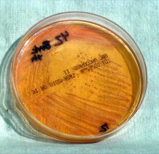 Free Picture: Colonial, Morphology, Burkholderia Pseudomallei, Grown ...