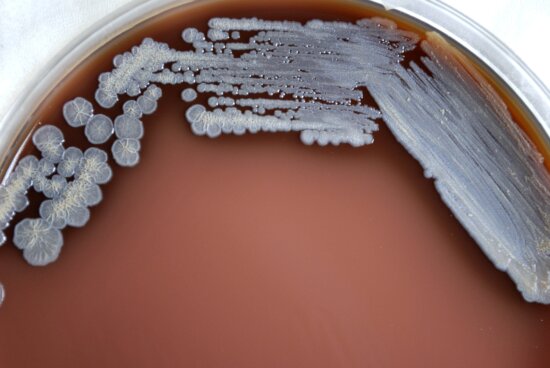 burkholderia pseudomallei, bacteria, grown, chocolate, agar