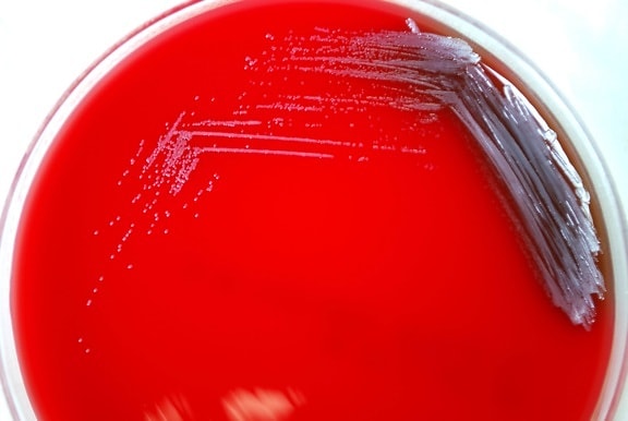 Burkholderia, pseudomallei, batteri, cresciuto, agar sangue