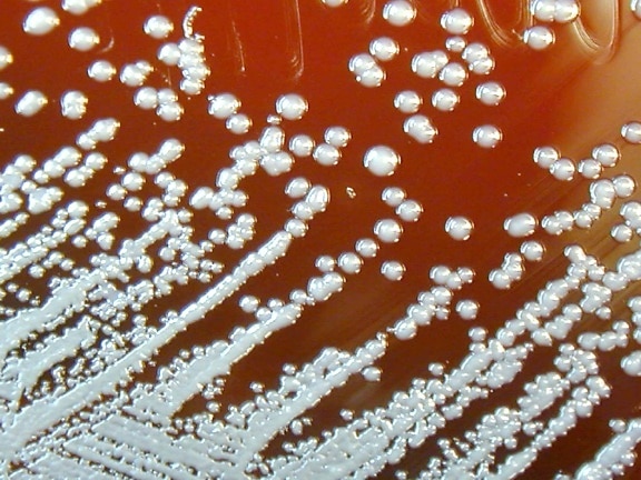 Burkholderia pseudomallei, tumbuh, domba, agar darah, bakteri, sel-sel, darah