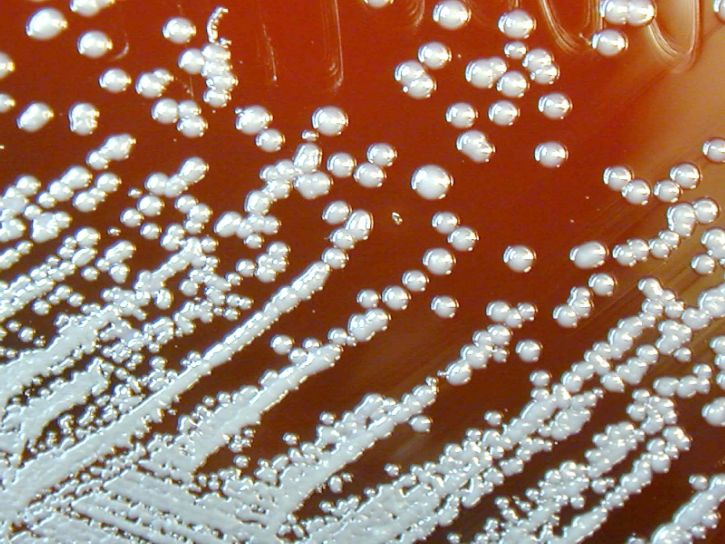 burkholderia pseudomallei, vokset, får, blod agar, bakterier, celler, blod