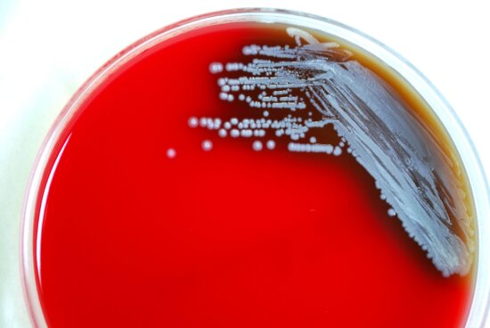 Free Picture: Gram, Negative, Burkholderia Pseudomallei, Bacteria ...