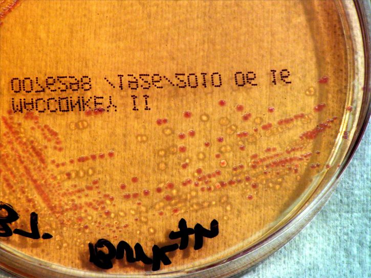 Pałeczka, thailandensis, bakterie, uprawiane, podłożu MacConkey'a, agar