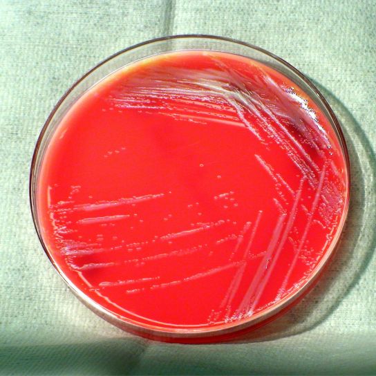 burkholderia thailandensis, bacteria, grown, blood agar