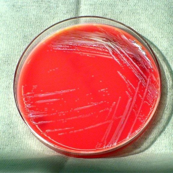 burkholderia thailandensis, bacteria, grown, blood agar